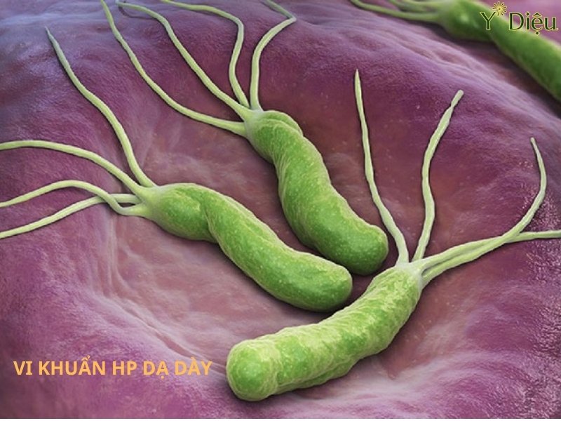 Virus HP Dạ Dày Phương Pháp Điều Trị Và Cách Ngăn Ngừa
