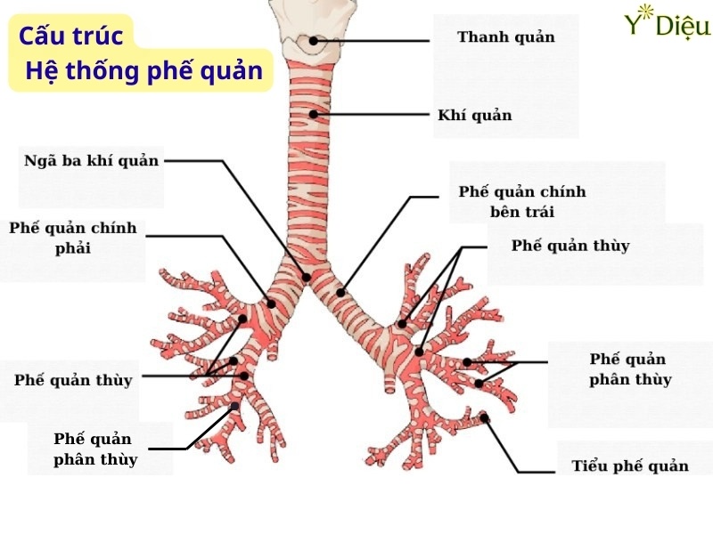 Giãn phế quản do viêm nhiễm kéo dài cũng có thể làm trẻ ho về đêm