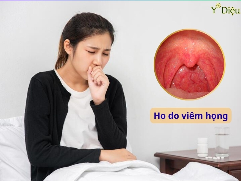 Cách trị ho bằng thiên môn đông trong điều trị ho do viêm hòng.