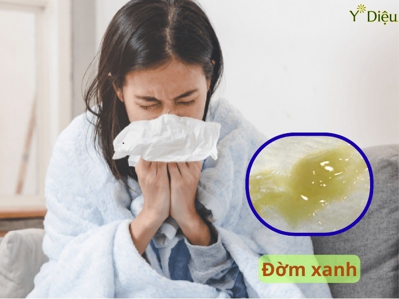 Hành tây có thể làm long đờm và tống xuất đờm ra ngoài