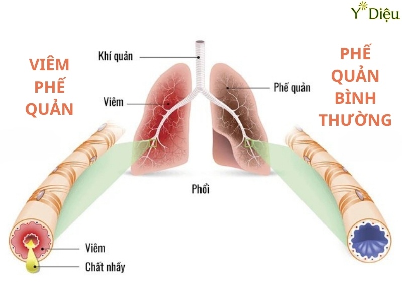 Rễ bạch môn có tác dụng giãn cơ trơn phế quản, giúp cải thiện lưu thông khí.