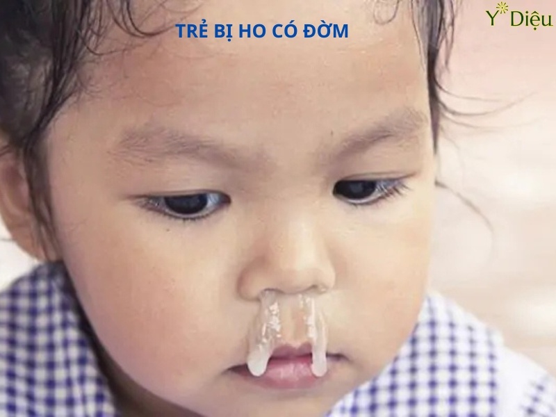 Prospan là một trong những siro giảm ho cho trẻ em được tin dùng rộng rãi